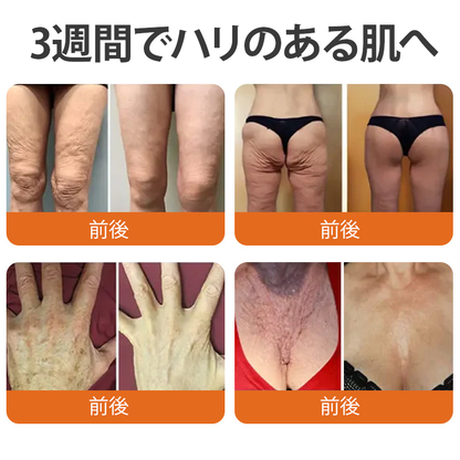 ✅✅ Cusire®ビーベノム リペア再生クリーム🔥天然由来のエイジングケアで肌を引き締め、ハリを与え、乾燥による小ジワを目立たなくします – 50mL