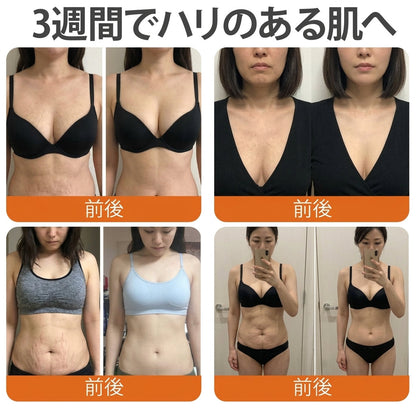 ✅✅ Cusire®ビーベノム リペア再生クリーム🔥天然由来のエイジングケアで肌を引き締め、ハリを与え、乾燥による小ジワを目立たなくします – 50mL