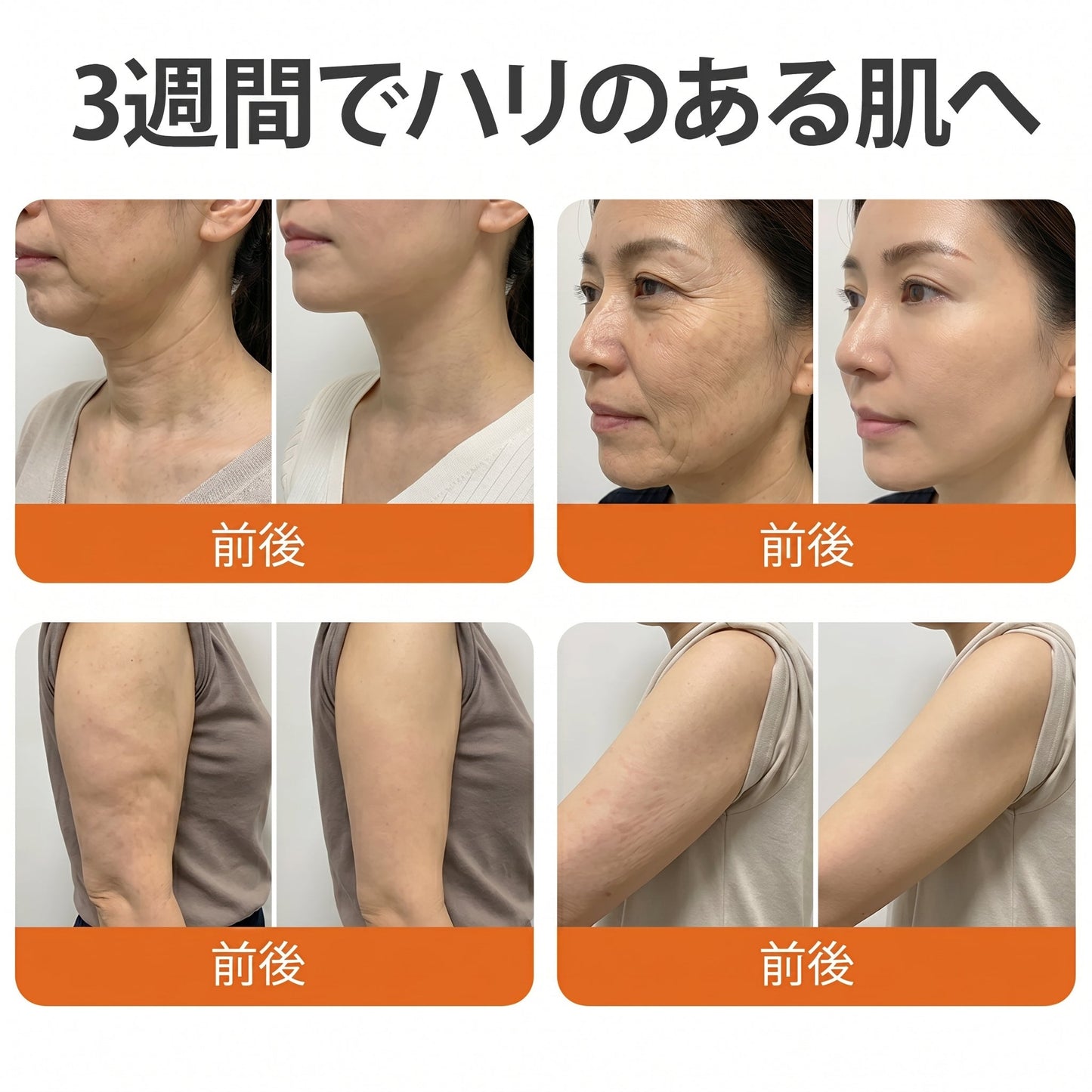 ✅✅ Cusire®ビーベノム リペア再生クリーム🔥天然由来のエイジングケアで肌を引き締め、ハリを与え、乾燥による小ジワを目立たなくします – 50mL