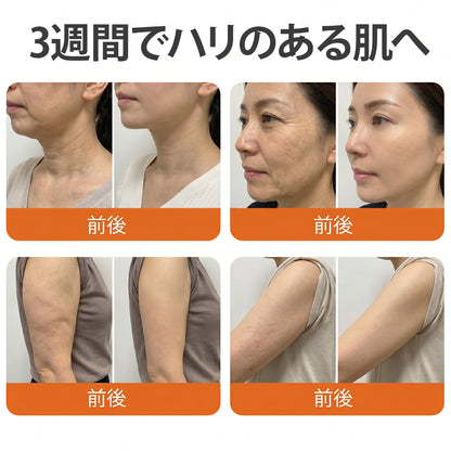 ✅✅ Cusire®ビーベノム リペア再生クリーム🔥天然由来のエイジングケアで肌を引き締め、ハリを与え、乾燥による小ジワを目立たなくします – 50mL